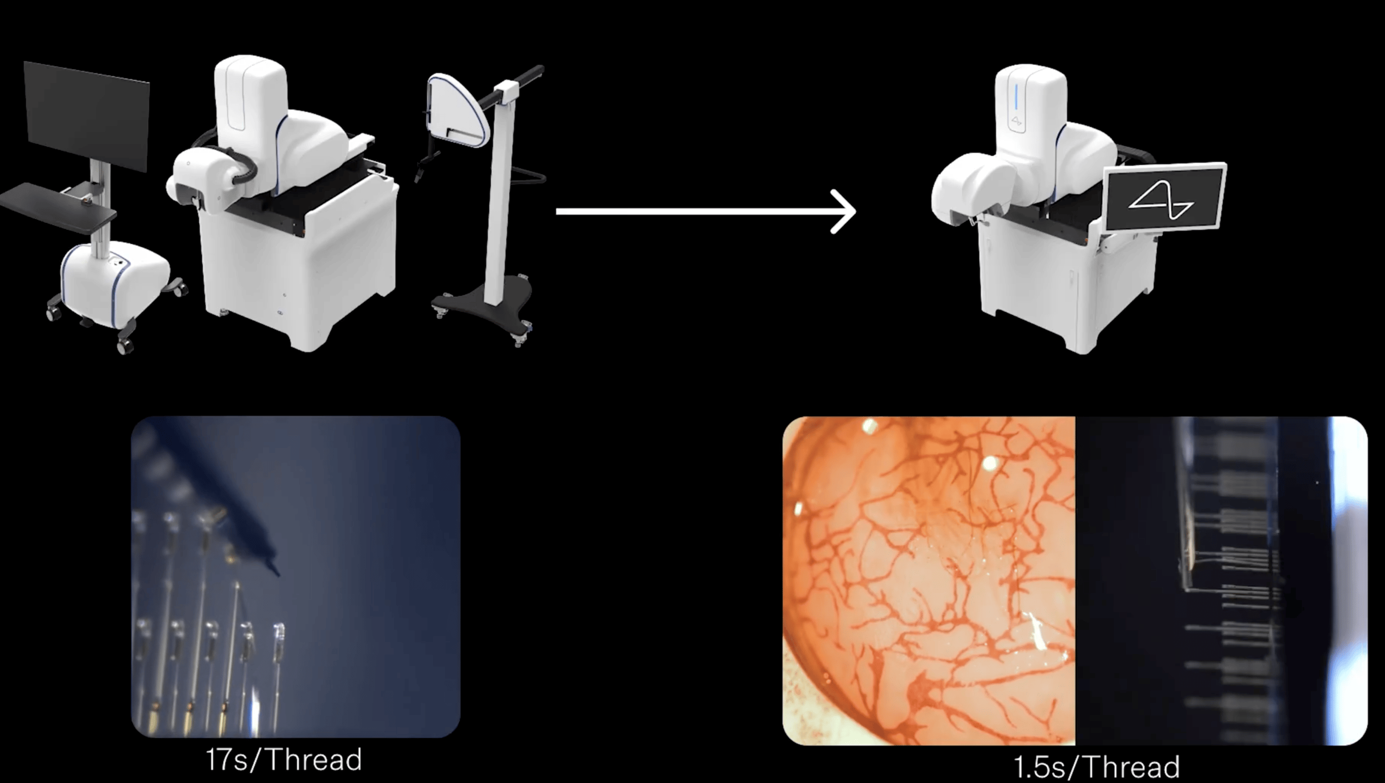 马斯克Neuralink疯狂计划曝光:5万美元一台手术,要把人类变成“超能力机器人”