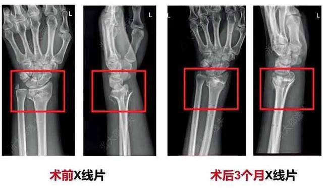 世界性难题，攻克了？